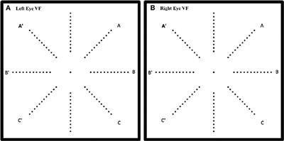 Peripheral Visual Reaction Time Is Faster in Deaf Adults and British Sign Language Interpreters than in Hearing Adults